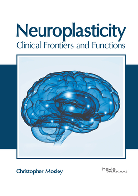 けまで 【中古】【輸入品・未使用】Neuroplasticity: Clinical