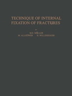 Technique of Internal Fixation of Fractures Cover Image