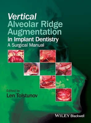 Vertical Alveolar Ridge Augmentation in Implant Dentistry: A Surgical Manual By Len Tolstunov (Editor) Cover Image