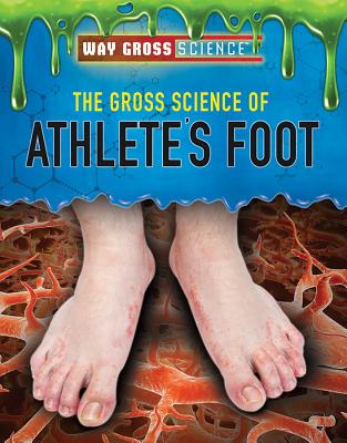 The Gross Science of Athlete's Foot (Way Gross Science)