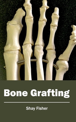 Bone Grafting By Shay Fisher (Editor) Cover Image