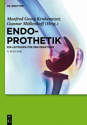 Endoprothetik Cover Image