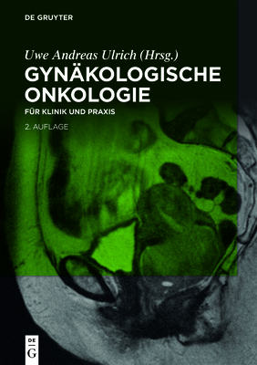 Gynäkologische Onkologie: Für Klinik Und PRAXIS Cover Image