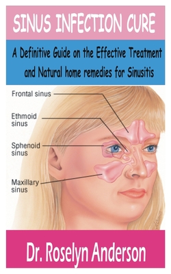 Sinus Infection Cure: A Definitive Guide on the effective treatment and natural home remedies for sinusitis By Roselyn Anderson Cover Image