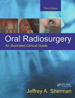 Oral Radiosurgery: An Illustrated Clinical Guide Cover Image