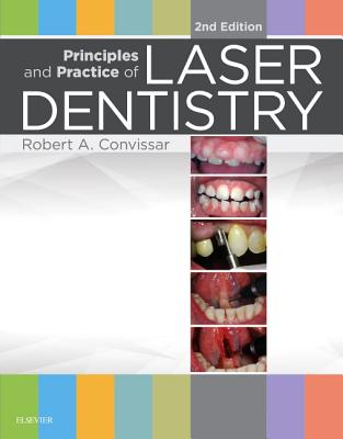 Principles and Practice of Laser Dentistry Cover Image