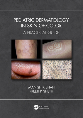 Pediatric Dermatology in Skin of Color: A Practical Guide