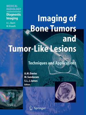 Imaging of Bone Tumors and Tumor-Like Lesions: Techniques and Applications Cover Image