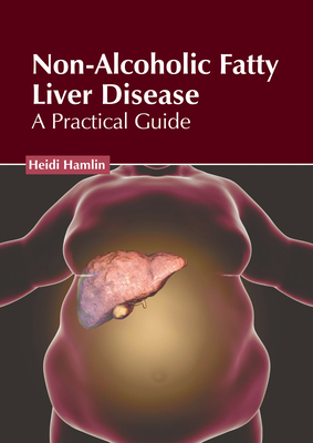 Non-Alcoholic Fatty Liver Disease: A Practical Guide Cover Image