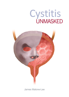 Cystitis Unmasked By James Malone-Lee Cover Image