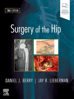 Surgery of the Hip Cover Image