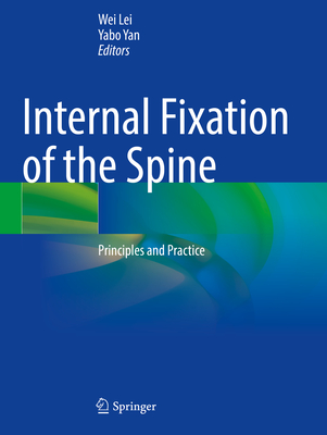 Internal Fixation of the Spine: Principles and Practice Cover Image