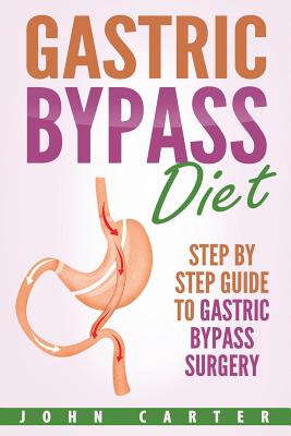 Gastric Bypass Diet: Step By Step Guide to Gastric Bypass Surgery By John Carter Cover Image
