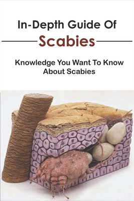 In-Depth Scabies Guide eBook *Free with Any Scabies Pack* ($9.99 value)