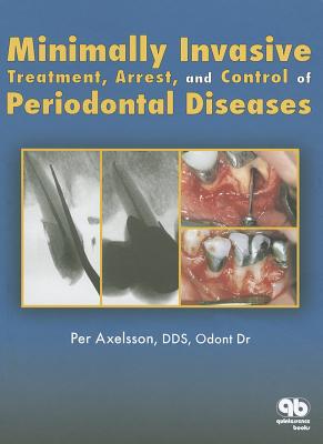 Minimally Invasive Treatment, Arrest and Control of Periodontal Diseases (Axelsson Series on Preventive Dentistry #5) By Per Axelsson Cover Image