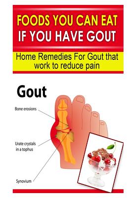 Foods You Can Eat If You Have Gout: Home Remedies for Gout That Work to Reduce Pain By Doc Goodman Cover Image