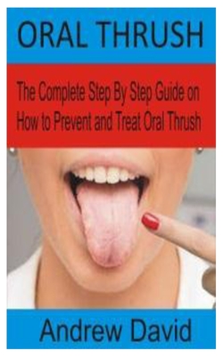 Oral Thrush: The Complete Step By Step Guide on How to Prevent and Treat Oral Thrush