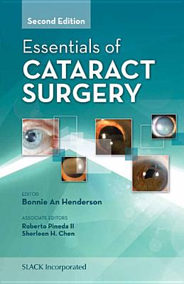 Essentials of Cataract Surgery Cover Image