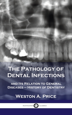 Pathology of Dental Infections: and Its Relation to General Diseases - History of Dentistry Cover Image