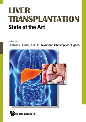 Liver Transplantation: State of the Art By Abhinav Humar (Editor), Christopher B. Hughes (Editor), Amit D. Tevar (Editor) Cover Image