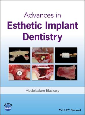 Advances in Esthetic Implant Dentistry Cover Image