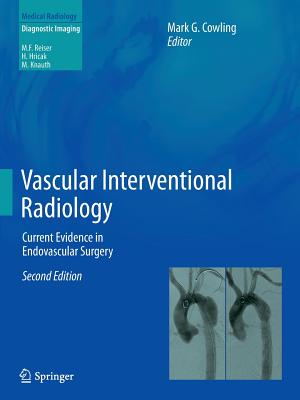 Vascular Interventional Radiology: Current Evidence in Endovascular Surgery Cover Image
