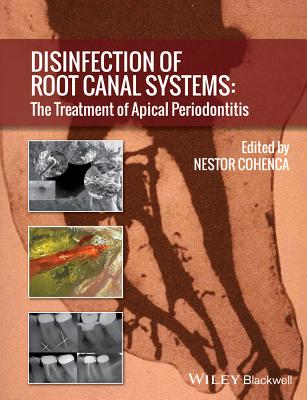 Disinfection of Root Canal Systems: The Treatment of Apical Periodontitis Cover Image