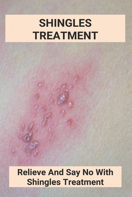Shingles Treatment: Relieve And Say No With Shingles Treatment: Shingles On Face Treatment Cover Image