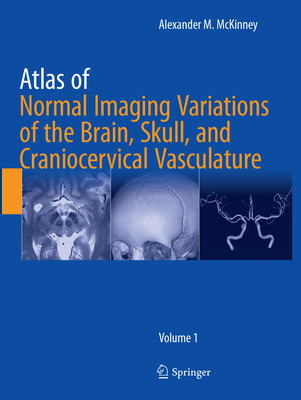 Atlas of Normal Imaging Variations of the Brain, Skull, and Craniocervical Vasculature By Alexander M. McKinney Cover Image