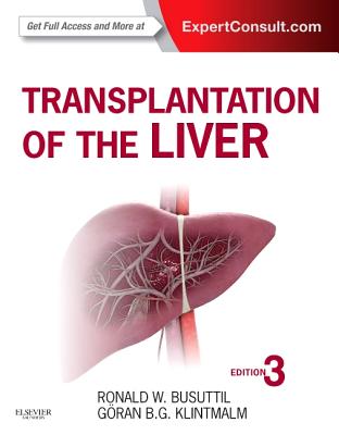 Transplantation of the Liver By Ronald W. Busuttil, Goran B. Klintmalm Cover Image