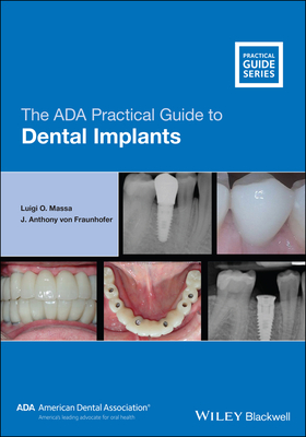 The ADA Practical Guide to Dental Implants Cover Image