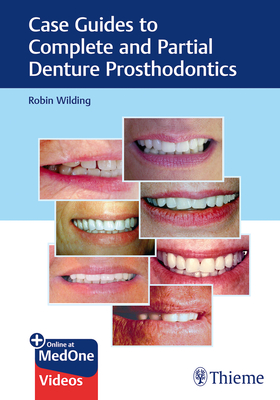 Case Guides to Complete and Partial Denture Prosthodontics Cover Image