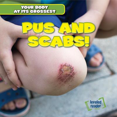 Pus and Scabs! (Your Body at Its Grossest) By Melvin Hightower Cover Image