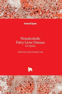 Nonalcoholic Fatty Liver Disease: An Update Cover Image