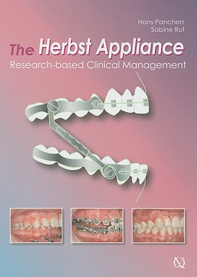 The Herbst Appliance: Research-Based Clinical Management By Hans Pancherz Cover Image
