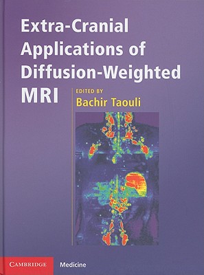 Extra-Cranial Applications of Diffusion-Weighted MRI (Cambridge Medicine) Cover Image