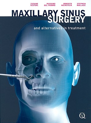 Maxillary Sinus Surgery And Alternatives In Treatment Hardcover Rj Julia Booksellers