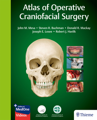 Atlas of Operative Craniofacial Surgery Cover Image