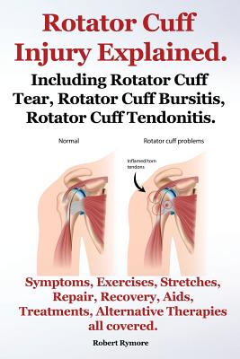 Rotator Cuff Injury Explained. Including Rotator Cuff Tear, Rotator Cuff Bursitis, Rotator Cuff Tendonitis. Symptoms, Exercises, Stretches, Repair, Re Cover Image