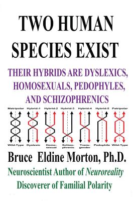 Two Human Species Exist: Their Hybrids Are Dylsexics, Homosexuals, Pedophiles, and Schizophrenics Cover Image
