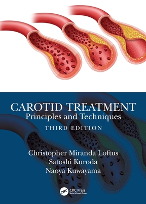 Carotid Treatment: Principles and Techniques By Christopher Miranda Loftus, Satoshi Kuroda, Naoya Kuwayama Cover Image