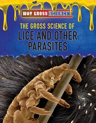 The Gross Science of Lice and Other Parasites (Way Gross Science)