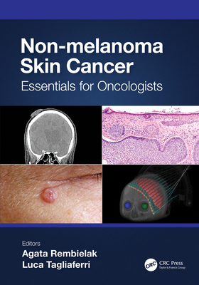 Non-Melanoma Skin Cancer: Essentials for Oncologists By Agata Rembielak (Editor), Luca Tagliaferri (Editor) Cover Image