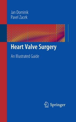 Heart Valve Surgery: An Illustrated Guide Cover Image