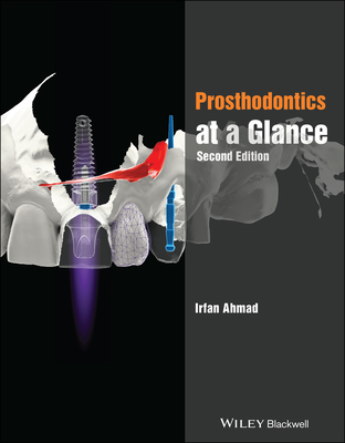 Prosthodontics at a Glance (At a Glance (Dentistry)) By Irfan Ahmad Cover Image