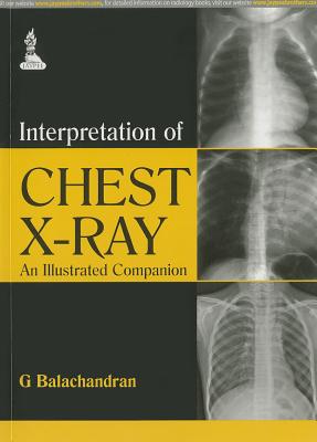 Interpretation of Chest X-Ray: An Illustrated Companion By G. Balachandran Cover Image