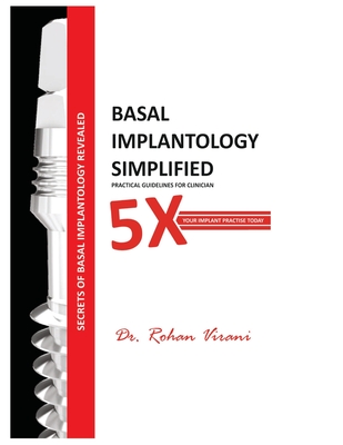 Basal Implantology Simplified: 5x YOUR IMPLANT PRACTISE By Rohan Virani Cover Image