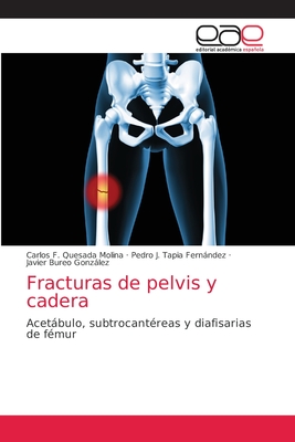 Fracturas de pelvis y cadera Fracturas de pelvis y cadera cover