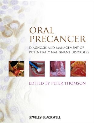 Oral Precancer: Diagnosis and Management of Potentially Malignant Disorders Cover Image