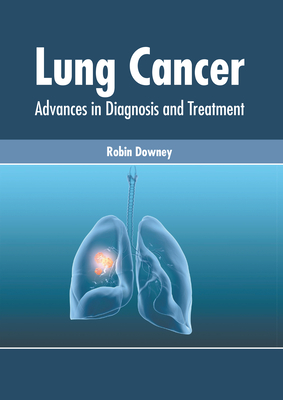 Lung Cancer: Advances in Diagnosis and Treatment By Robin Downey (Editor) Cover Image